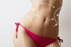 Before And After Images -  Liposuction