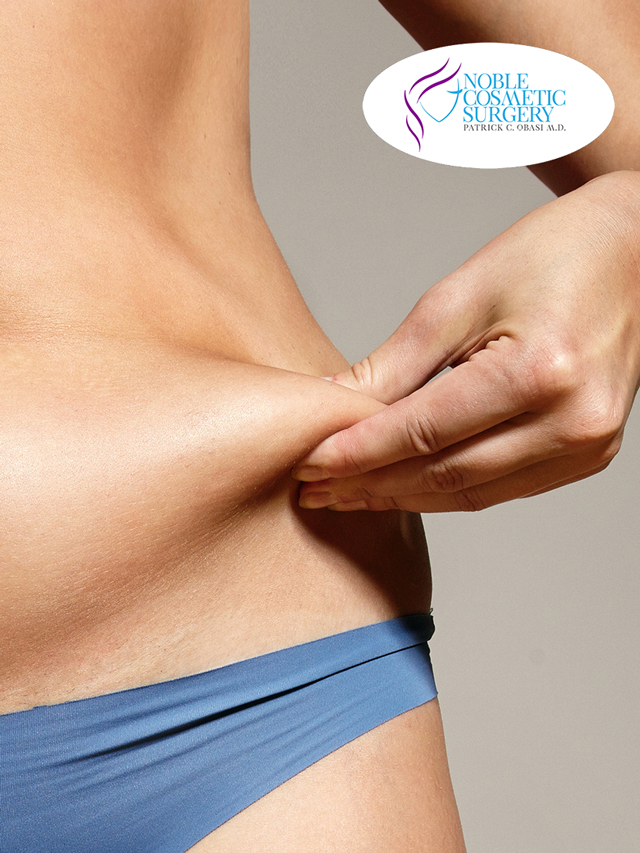 Are You A Good Candidate For a Tummy Tuck