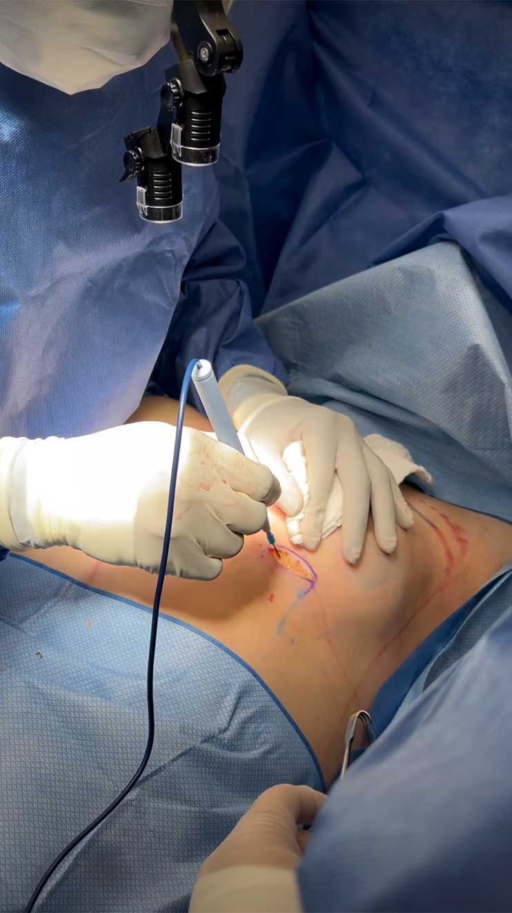 Surgery of the day